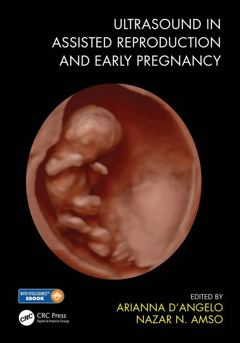 Arianna D'Angelo, Nazar N. Amso - Ultrasound in Assisted Reproduction and Early Pregnancy, Häftad. Tillgänglighet: Lägg i varukorg