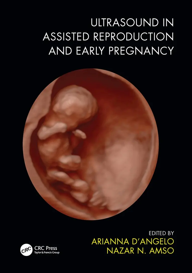 Arianna D'Angelo, Nazar N. Amso - Ultrasound in Assisted Reproduction and Early Pregnancy, Inbunden. Tillgänglighet: Lägg i varukorg