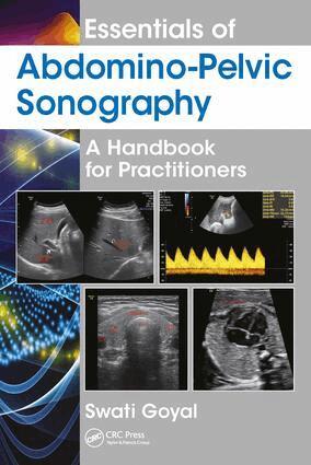 Swati Goyal - Essentials of Abdomino-Pelvic Sonography, Inbunden. Tillgänglighet: Lägg i varukorg