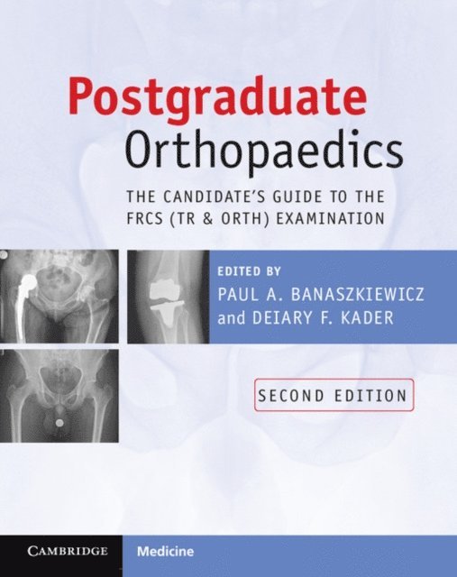 Deiary F. Kader, Paul A. Banaszkiewicz - Postgraduate Orthopaedics, E-bok