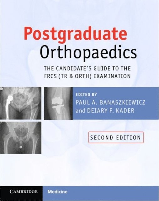 Deiary F. Kader, Paul A. Banaszkiewicz - Postgraduate Orthopaedics, E-bok
