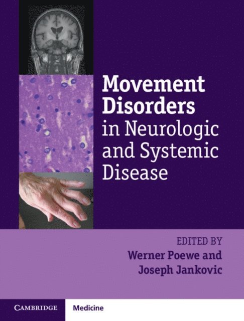 Joseph Jankovic, Werner Poewe - Movement Disorders in Neurologic and Systemic Disease, E-bok