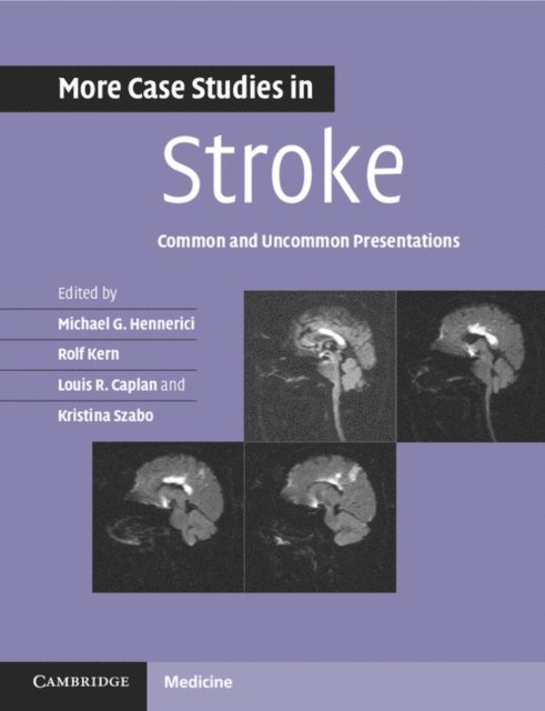 Kristina Szabo, Louis R. Caplan, Rolf Kern, Michael G. Hennerici - More Case Studies in Stroke, E-bok