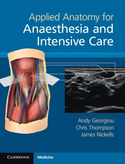 James Nickells, Chris Thompson, Andy Georgiou - Applied Anatomy for Anaesthesia and Intensive Care, E-bok
