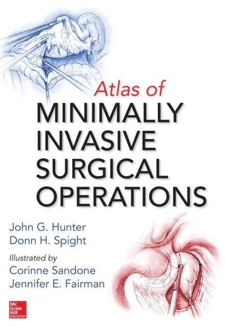 Donn H. Spight, John G. Hunter - Atlas of Minimally Invasive Surgical Operations, E-bok