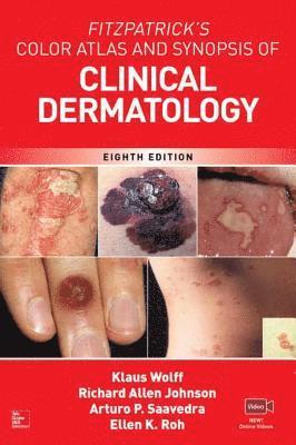 Ellen K. Roh, Arturo Saavedra, Richard C. Johnson, Klaus Wolff - Fitzpatrick's Color Atlas and Synopsis of Clinical Dermatology, Eighth Edition, E-bok