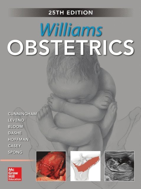 Barbara L. Hoffman, Catherine Y. Spong, Steven L. Bloom, Jodi S. Dashe - Williams Obstetrics, 25th Edition, E-bok