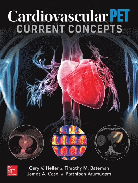 Gary V. Heller - Cardiovascular PET: Current Concepts, E-bok