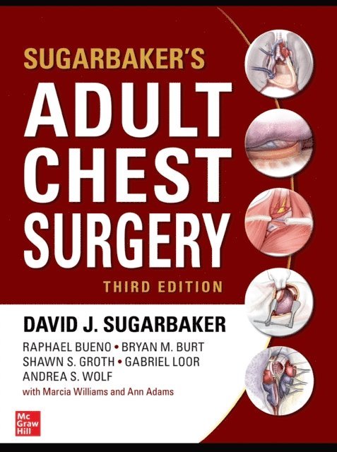 Andrea S. Wolf, Gabriel Loor, Shawn S. Groth, Bryan M. Burt, Raphael Bueno, David J. Sugarbaker - Sugarbaker's Adult Chest Surgery, Third Edition, E-bok
