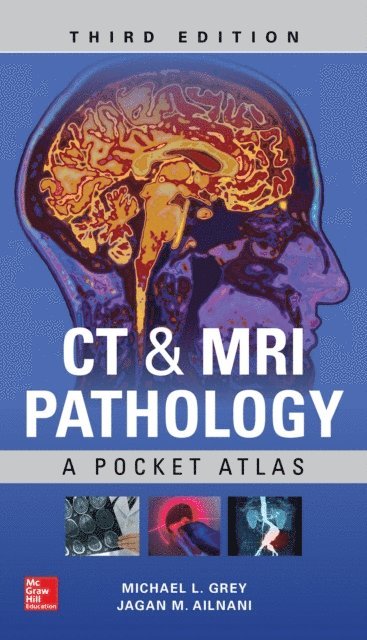 Jagan Mohan Ailinani, Michael L. Grey - CT & MRI Pathology: A Pocket Atlas, Third Edition, E-bok