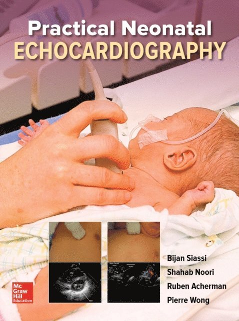 Ruben Acherman, Pierre Wong, Shahab Noori, Bijan Siassi - Practical Neonatal Echocardiography, E-bok. Tillgänglighet: Lägg i varukorg