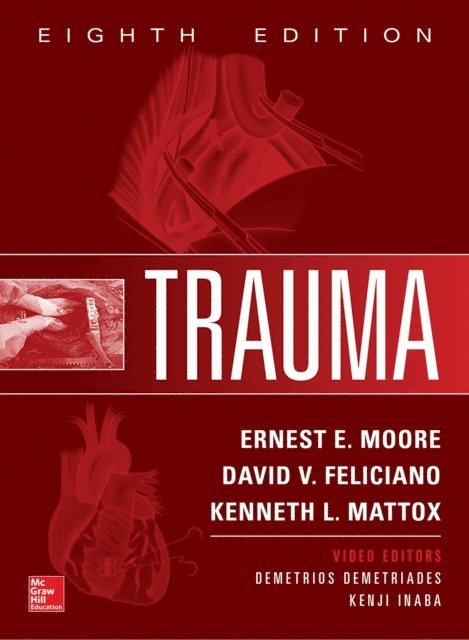 Kenneth L. Mattox, David V. Feliciano, Ernest E. Moore - Trauma, 8th Edition, E-bok