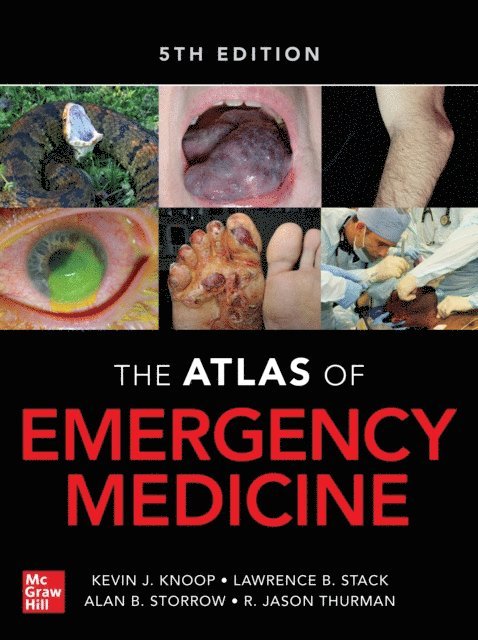 R. Jason Thurman, Alan B. Storrow, Lawrence B. Stack, Kevin J. Knoop - Atlas of Emergency Medicine, Fifth Edition, E-bok