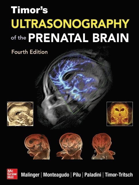 Gustavo Malinger, Gianluigi Pilu, Ana Monteagudo, Ilan Timor-Tritsch - Timor's Ultrasonography of the Prenatal Brain, Fourth Edition, E-bok