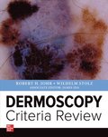 Dermoscopy  Criteria Review
