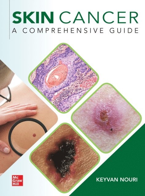 Keyvan Nouri - Skin Cancer: A Comprehensive Guide, E-bok