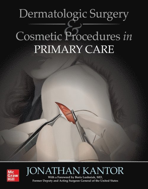Jonathan Kantor - Dermatologic Surgery and Cosmetic Procedures in Primary Care Practice, E-bok