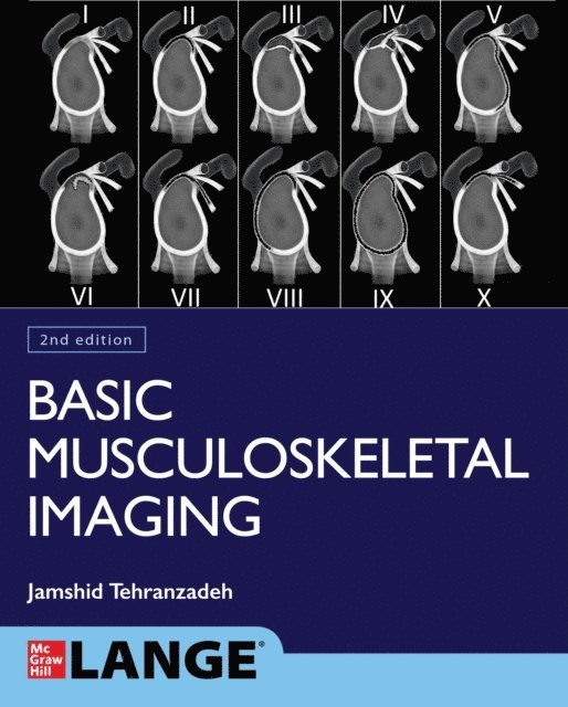 Jamshid Tehranzadeh - Basic Musculoskeletal Imaging, Second Edition, E-bok