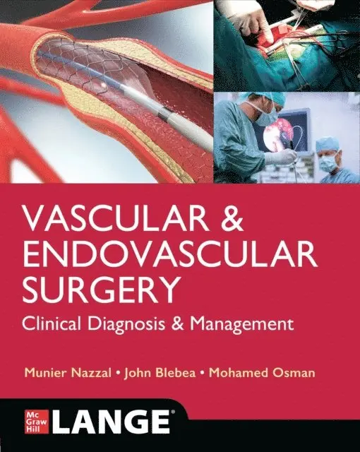 Mohamed Osman, John Blebea, Munier Nazzal - LANGE Vascular and Endovascular Surgery: Clinical Diagnosis and Management, E-bok. Tillgänglighet: Lägg i varukorg