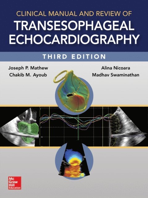 Chakib Ayoub, Madhav Swaminathan, Joseph Mathew - Clinical Manual and Review of Transesophageal Echocardiography, 3/e, E-bok