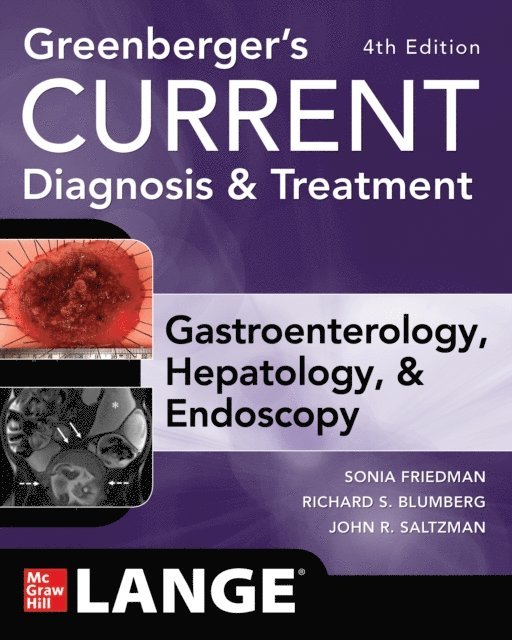 Norton Greenberger, John Saltzman, Sonia Friedman, Richard Blumberg - Greenberger's CURRENT Diagnosis & Treatment Gastroenterology, Hepatology, & Endoscopy, Fourth Edition, E-bok