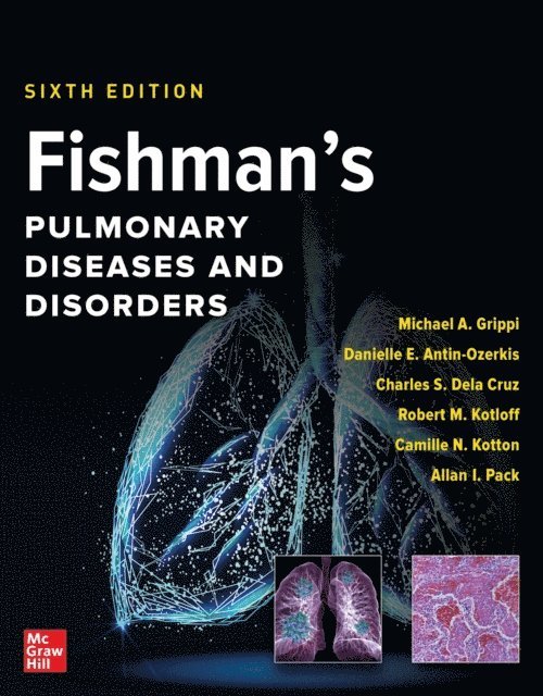 Allan I. Pack, Camille N. Kotton, Robert Kotloff, Charles S. Dela Cruz, Danielle E. Antin-Ozerkis, Michael A. Grippi - Fishman's Pulmonary Diseases and Disorders, 2-Volume Set, Sixth Edition, E-bok