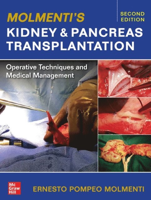 Ernesto P. Molmenti - Molmenti's Kidney and Pancreas Transplantation: Operative Techniques and Medical Management, E-bok