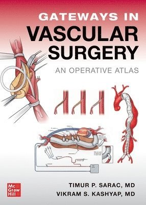 Timur Sarac, Vikram Kashyap - Gateways in Vascular Surgery: An Operative Atlas, Inbunden