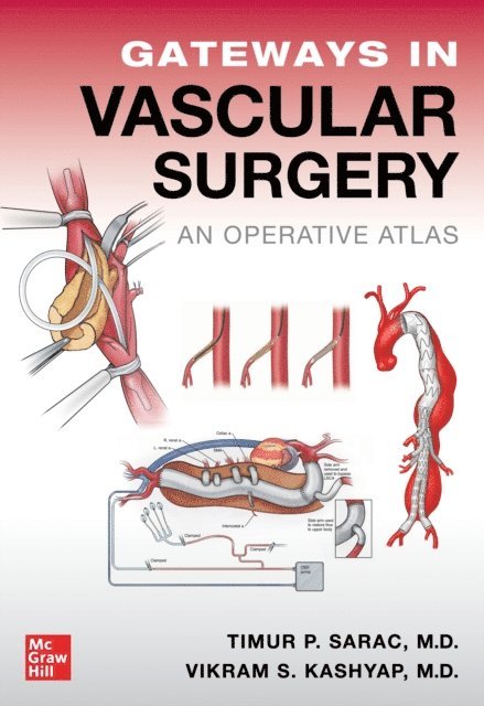 Vikram S. Kashyap, Timur Sarac - Gateways in Vascular Surgery: An Operative Atlas, E-bok