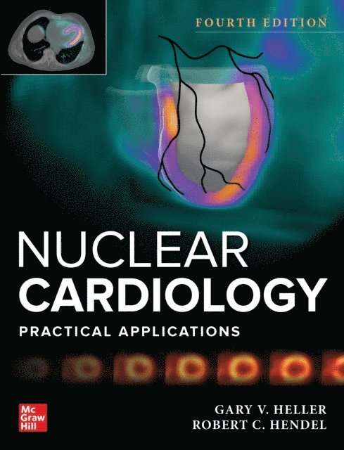 Robert C. Hendel, Gary V. Heller - Nuclear Cardiology: Practical Applications, Fourth Edition, E-bok