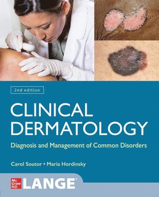 Carol Soutor, Maria Hordinsky - Clinical Dermatology: Diagnosis and Management of Common Disorders, Second Edition, Häftad. Tillgänglighet: Lägg i varukorg