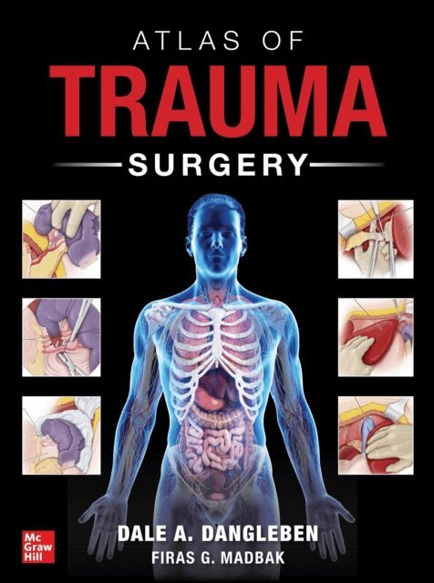 Firas G Madbak, Dale A. Dangleben - Atlas of Trauma Surgery, E-bok