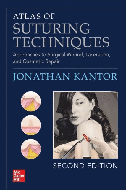 Jonathan Kantor - Atlas of Suturing Techniques: Approaches to Surgical Wound, Laceration, and Cosmetic Repair, Second Edition, E-bok