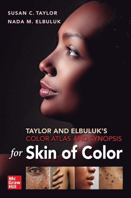 Nada Elbuluk, Susan C. Taylor - Taylor and Elbuluk's Color Atlas and Synopsis for Skin of Color, E-bok