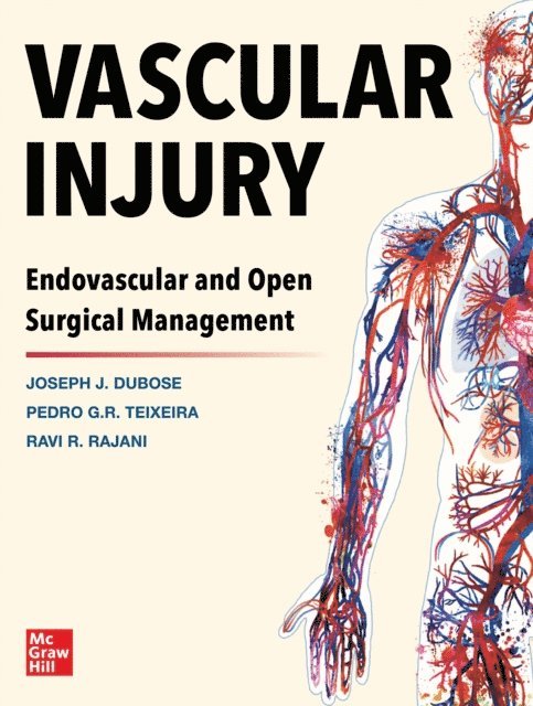 Ravi R. Rajani, Pedro G. Teixeira, Joe DuBose - Vascular Injury: Endovascular and Open Surgical Management, E-bok