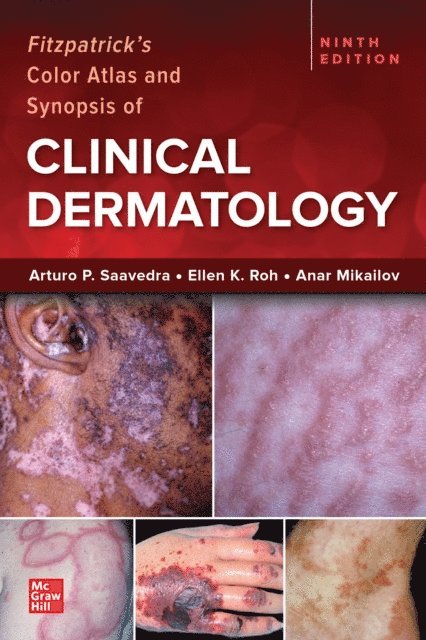 Anar Mikailov, Ellen K. Roh, Arturo P. Saavedra - Fitzpatrick's Color Atlas and Synopsis of Clinical Dermatology, Ninth Edition, E-bok