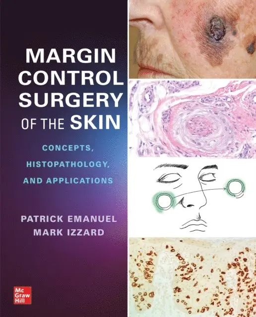 Margin Control Surgery of the Skin: Concepts, Histopathology, and Applications