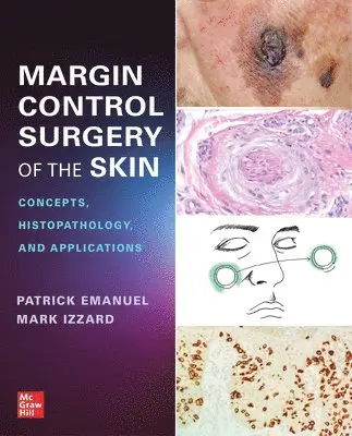 Patrick Emanuel, Mark Izzard - Margin Control Surgery of the Skin: Concepts, Histopathology, and Applications, Häftad. Tillgänglighet: Lägg i varukorg