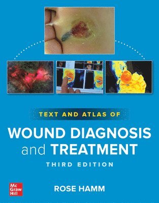 Rose Hamm - Text and Atlas of Wound Diagnosis and Treatment, Third Edition, Häftad. Tillgänglighet: Lägg i varukorg