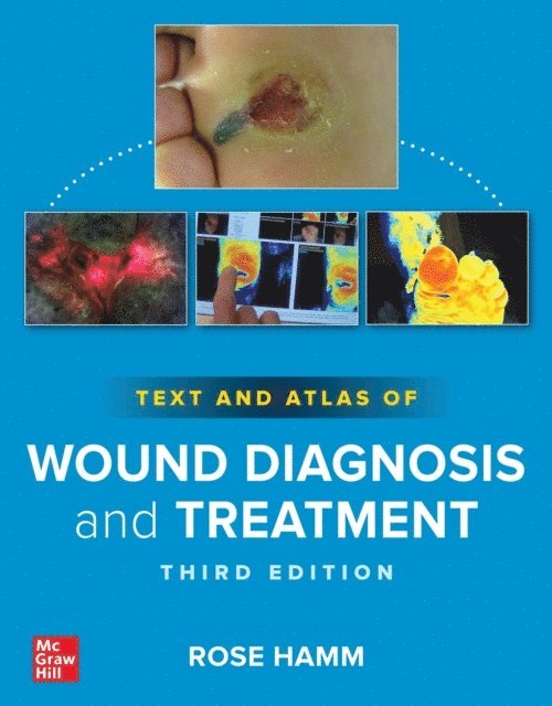 Rose Hamm - Text and Atlas of Wound Diagnosis and Treatment, Third Edition, E-bok. Tillgänglighet: Lägg i varukorg
