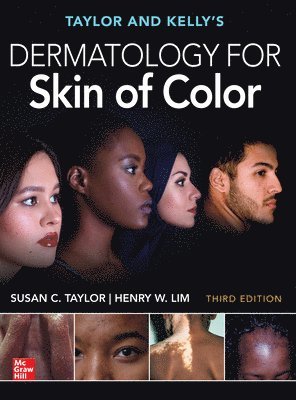Henry Lim, Susan C. Taylor - Taylor and Kelly's Dermatology for Skin of Color, Third Edition, E-bok