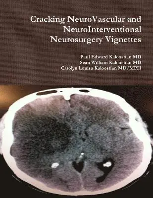 Paul Edward Kaloostian, Carolyn Louisa Kaloostian MD/Mph, Sean William Kaloostian - Cracking NeuroVascular and NeuroInterventional Neurosurgery Vignettes, Häftad. Tillgänglighet: Lägg i varukorg