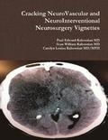 Cracking NeuroVascular and NeuroInterventional Neurosurgery Vignettes