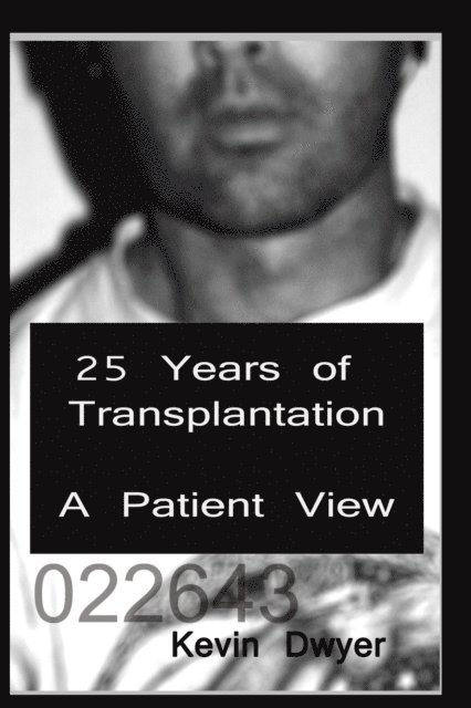 Kevin Dwyer - 25 Years of Transplantation - A Patient View, E-bok