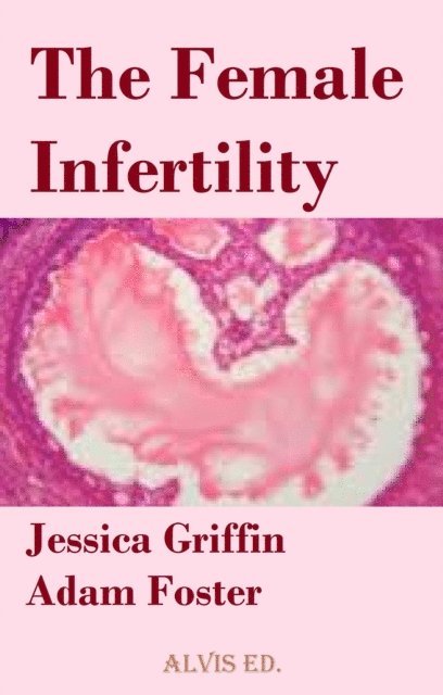 Jessica Griffin - Female Infertility, E-bok