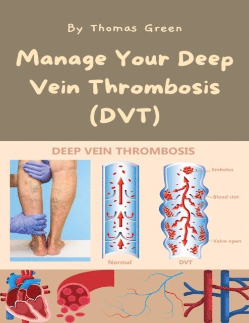 Thomas Green - Manage Your Deep Vein Thrombosis (DVT), E-bok