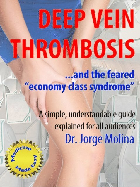 Jorge Molina - Deep Vein Thrombosis, E-bok