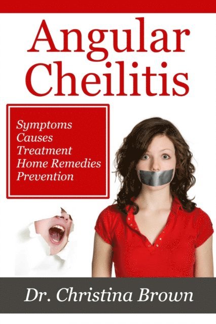 Christina Brown - Angular Cheilitis, E-bok