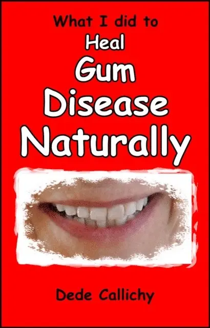 Dede Callichy - What I did to Heal Gum Disease Naturally, E-bok. Tillgänglighet: Lägg i varukorg