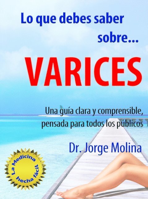 Jorge Molina - Lo que debes saber sobre... Varices, E-bok
